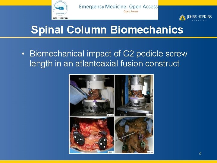 Spinal Column Biomechanics • Biomechanical impact of C 2 pedicle screw length in an