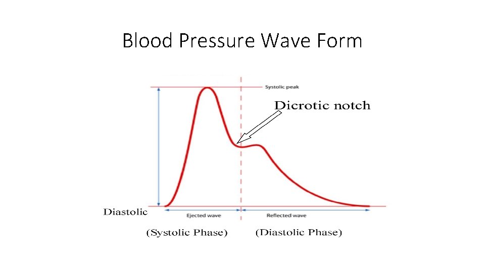Blood Pressure Wave Form 