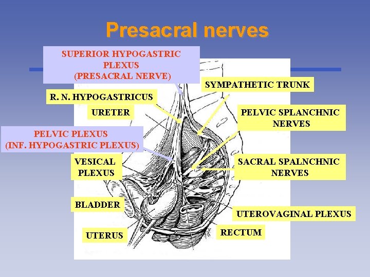 Presacral nerves SUPERIOR HYPOGASTRIC PLEXUS (PRESACRAL NERVE) SYMPATHETIC TRUNK R. N. HYPOGASTRICUS URETER PELVIC