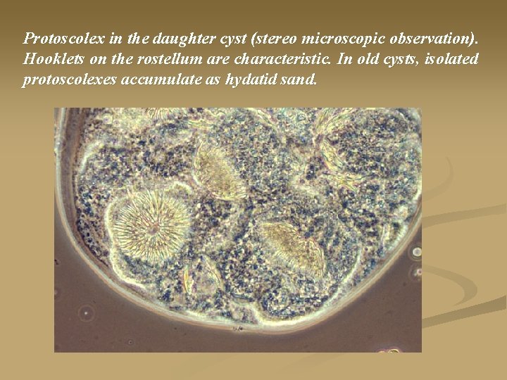 Protoscolex in the daughter cyst (stereo microscopic observation). Hooklets on the rostellum are characteristic.