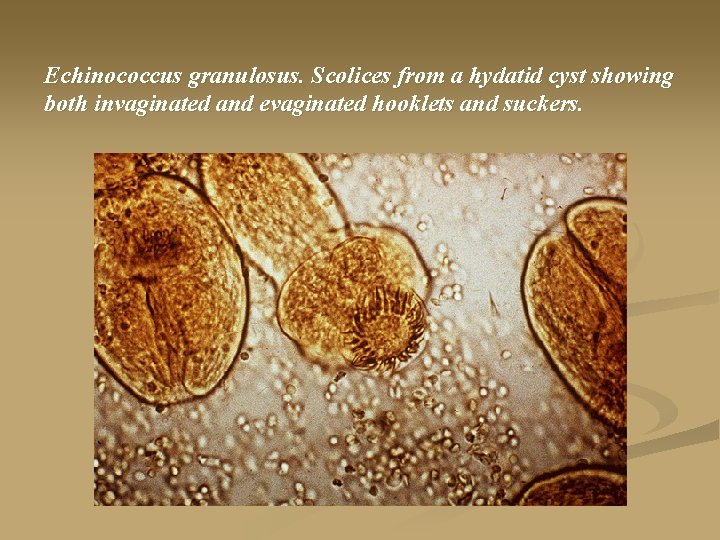 Echinococcus granulosus. Scolices from a hydatid cyst showing both invaginated and evaginated hooklets and