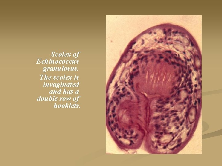 Scolex of Echinococcus granulosus. The scolex is invaginated and has a double row of