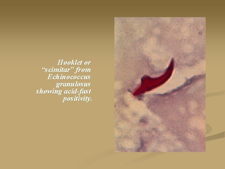 Hooklet or “scimitar” from Echinococcus granulosus showing acid-fast positivity. 