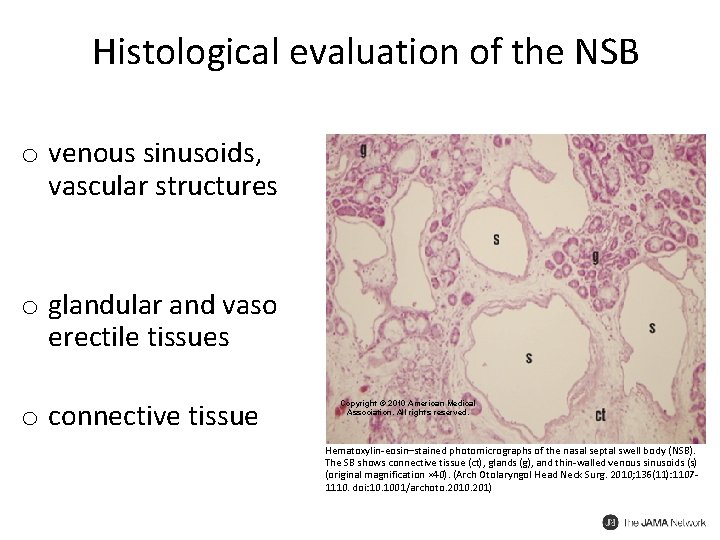 Histological evaluation of the NSB o venous sinusoids, vascular structures o glandular and vaso