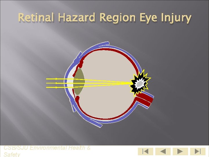 Retinal Hazard Region Eye Injury CSB/SJU Environmental Health & Safety 