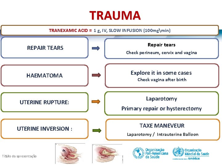 TRAUMA TRANEXAMIC ACID = 1 g, IV, SLOW INFUSION (100 mgmin) TRANEXAMIC ACID =