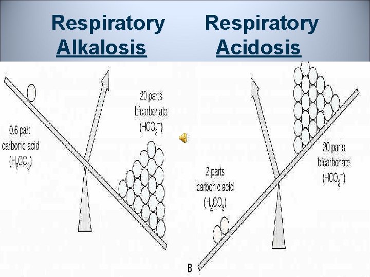 Respiratory Alkalosis Respiratory Acidosis 