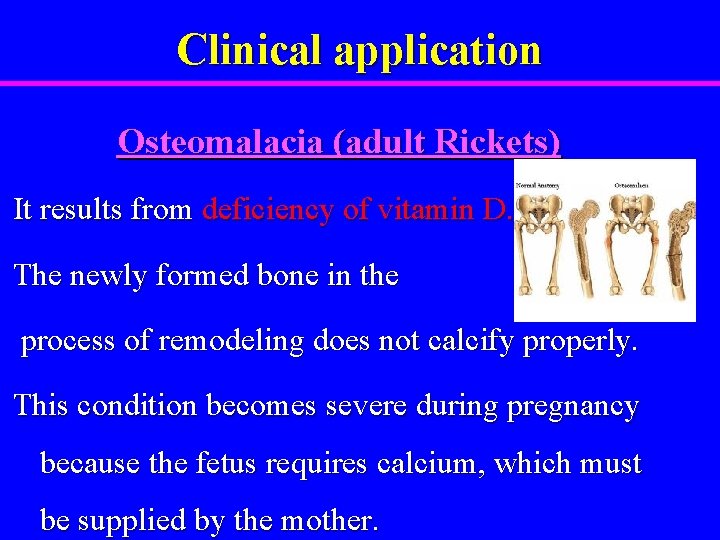 Clinical application Osteomalacia (adult Rickets) It results from deficiency of vitamin D. The newly
