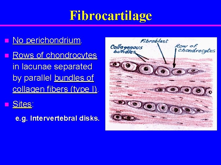 Fibrocartilage n No perichondrium. n Rows of chondrocytes in lacunae separated by parallel bundles