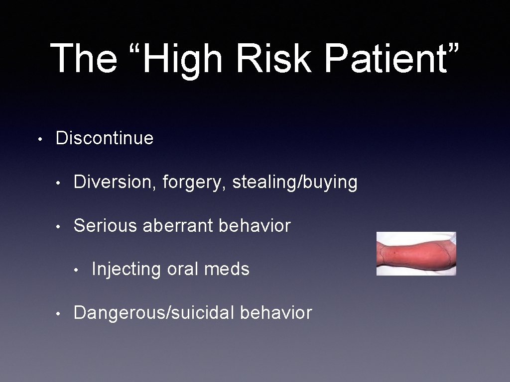 The “High Risk Patient” • Discontinue • Diversion, forgery, stealing/buying • Serious aberrant behavior