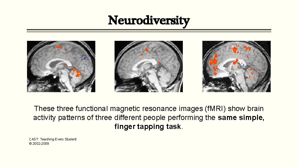 Neurodiversity These three functional magnetic resonance images (f. MRI) show brain activity patterns of