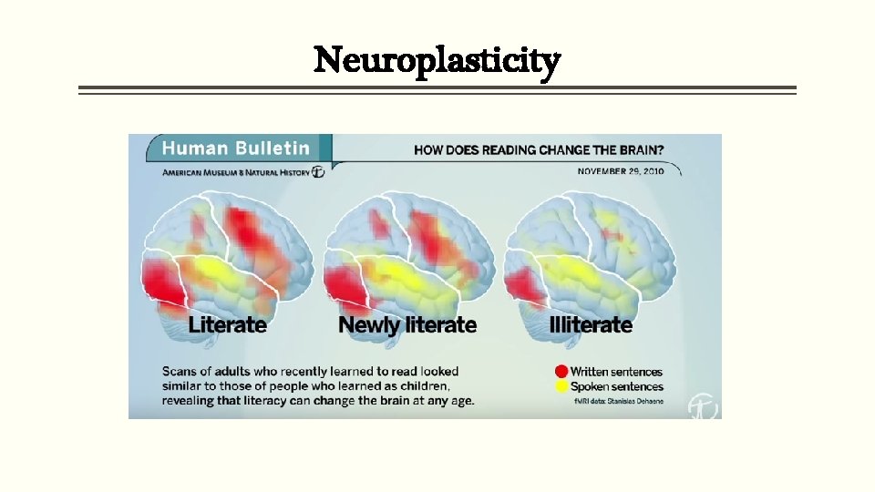 Neuroplasticity 