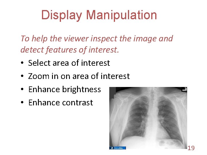 Display Manipulation To help the viewer inspect the image and detect features of interest.