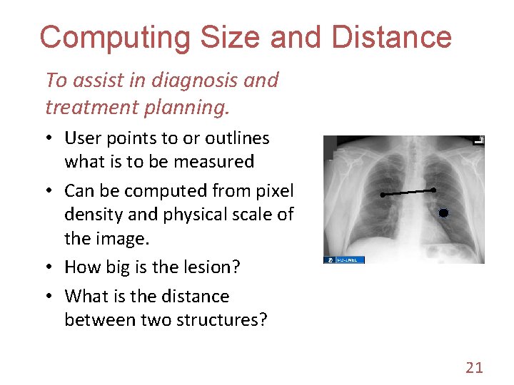 Computing Size and Distance To assist in diagnosis and treatment planning. • User points