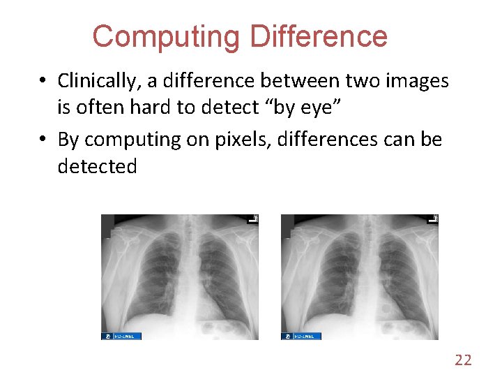 Computing Difference • Clinically, a difference between two images is often hard to detect