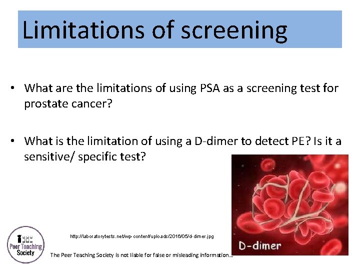 Limitations of screening • What are the limitations of using PSA as a screening