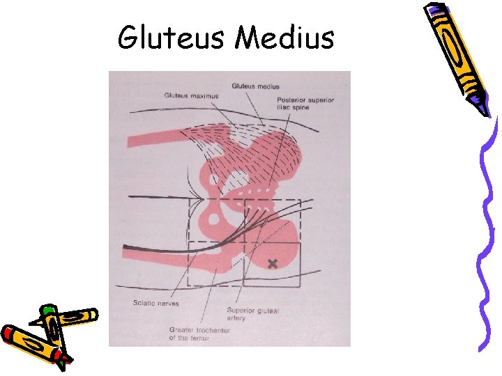 Gluteus Medius 