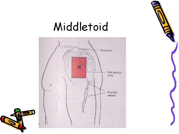 Middletoid 