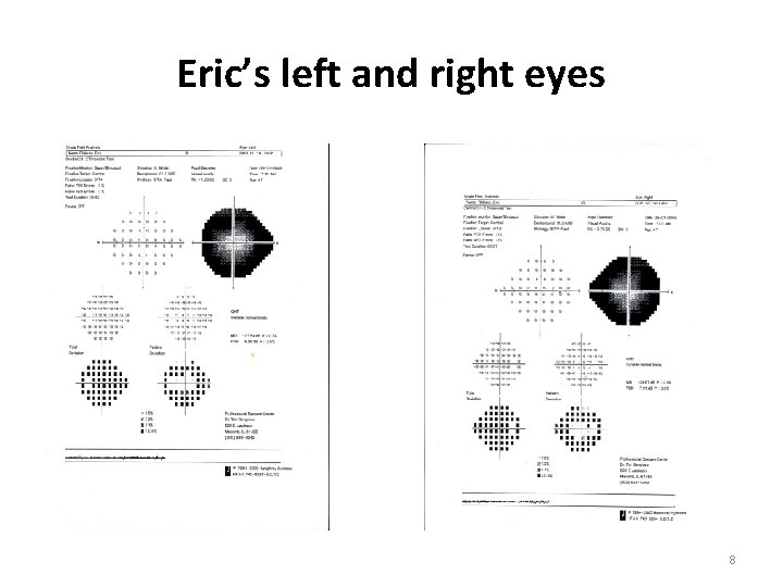 Eric’s left and right eyes 8 