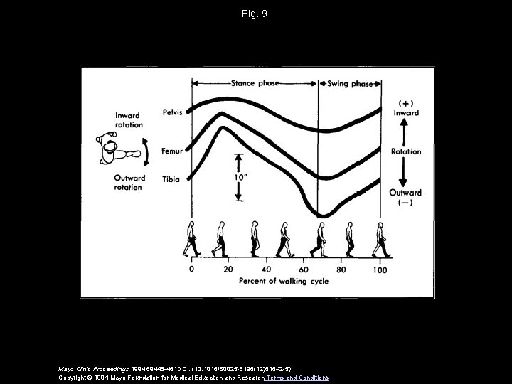 Fig. 9 Mayo Clinic Proceedings 1994 69448 -461 DOI: (10. 1016/S 0025 -6196(12)61642 -5)