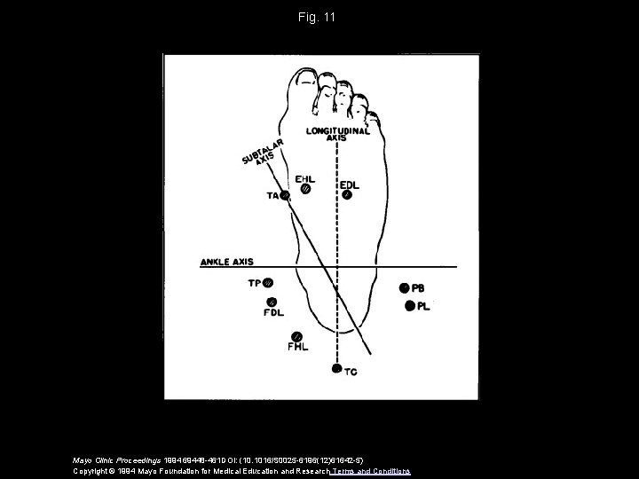 Fig. 11 Mayo Clinic Proceedings 1994 69448 -461 DOI: (10. 1016/S 0025 -6196(12)61642 -5)