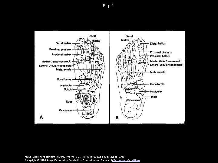 Fig. 1 Mayo Clinic Proceedings 1994 69448 -461 DOI: (10. 1016/S 0025 -6196(12)61642 -5)