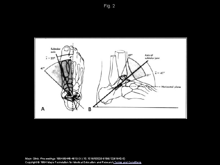 Fig. 2 Mayo Clinic Proceedings 1994 69448 -461 DOI: (10. 1016/S 0025 -6196(12)61642 -5)