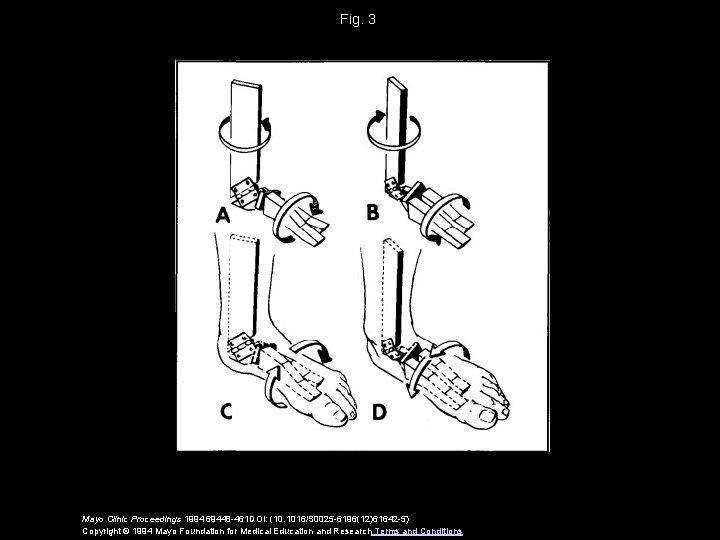 Fig. 3 Mayo Clinic Proceedings 1994 69448 -461 DOI: (10. 1016/S 0025 -6196(12)61642 -5)