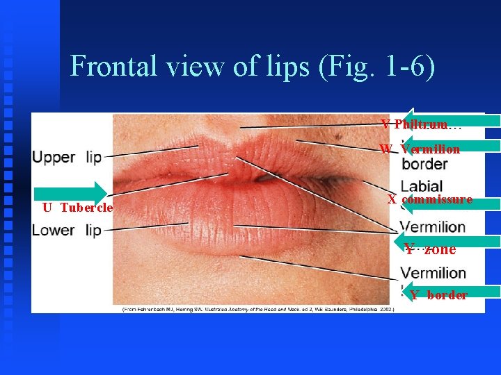 Frontal view of lips (Fig. 1 -6) V Philtrum W Vermilion U Tubercle X