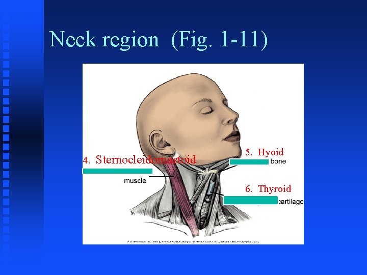 Neck region (Fig. 1 -11) 4. Sternocleidomastoid 5. Hyoid 6. Thyroid Neck region (Fig. 1 -11) 4. Sternocleidomastoid 5. Hyoid 6. Thyroid