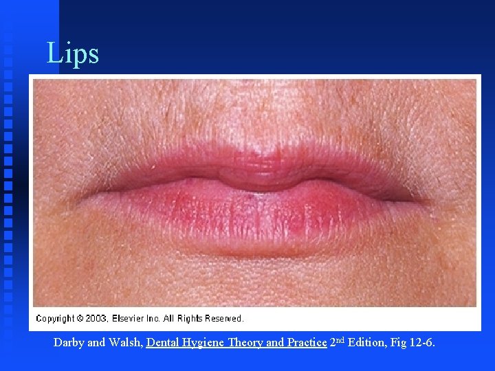 Lips Darby and Walsh, Dental Hygiene Theory and Practice 2 nd Edition, Fig 12 Lips Darby and Walsh, Dental Hygiene Theory and Practice 2 nd Edition, Fig 12
