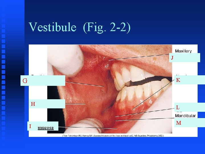 Vestibule (Fig. 2 -2) J K G H I L mucosa M Vestibule (Fig. 2 -2) J K G H I L mucosa M
