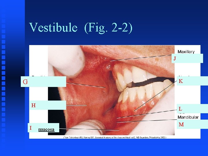 Vestibule (Fig. 2 -2) J K G H I L mucosa M 