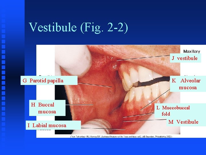 Vestibule (Fig. 2 -2) J vestibule G Parotid papilla H Buccal mucosa I Labial Vestibule (Fig. 2 -2) J vestibule G Parotid papilla H Buccal mucosa I Labial