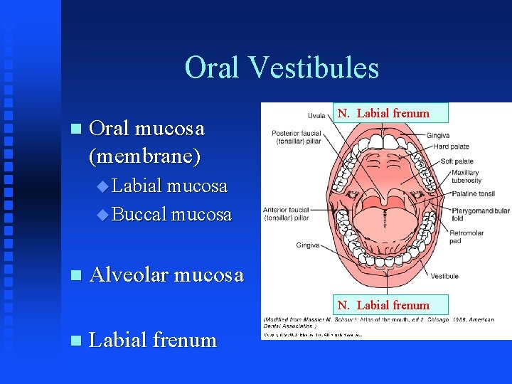 Oral Vestibules n Oral mucosa (membrane) N. Labial frenum u Labial mucosa u Buccal