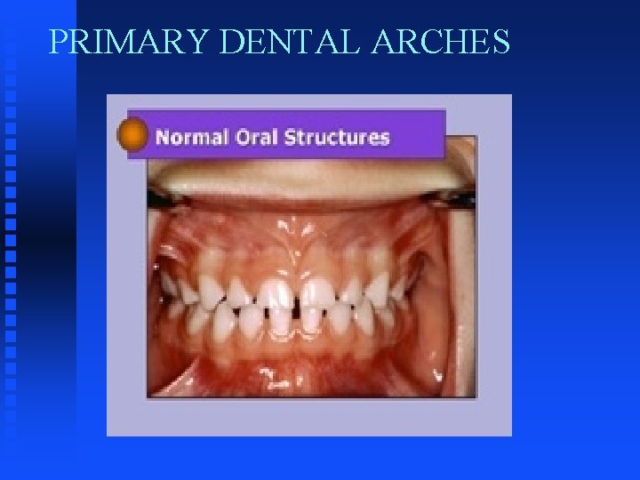 PRIMARY DENTAL ARCHES PRIMARY DENTAL ARCHES