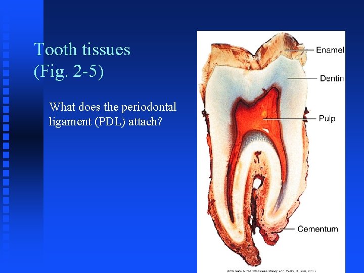 Tooth tissues (Fig. 2 -5) What does the periodontal ligament (PDL) attach? Tooth tissues (Fig. 2 -5) What does the periodontal ligament (PDL) attach?