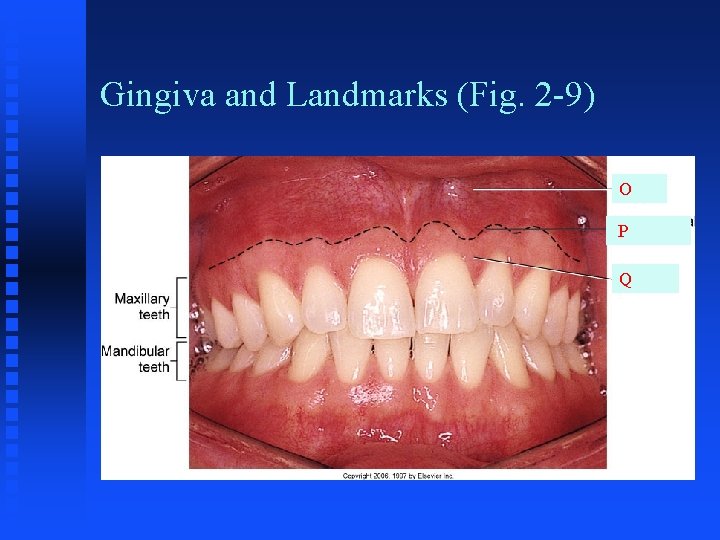 Gingiva and Landmarks (Fig. 2 -9) O P Q 