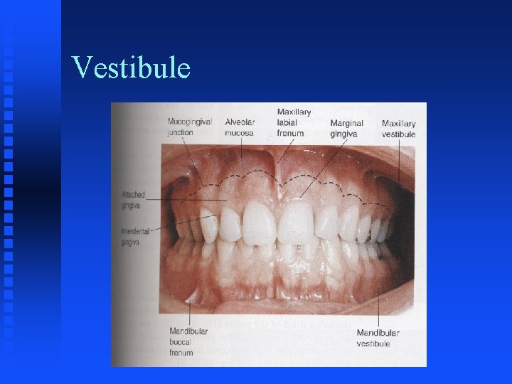 Vestibule Vestibule