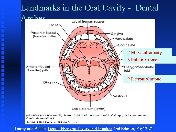 Landmarks in the Oral Cavity - Dental Arches 7 Max. tuberosity 8 Palatine tonsil