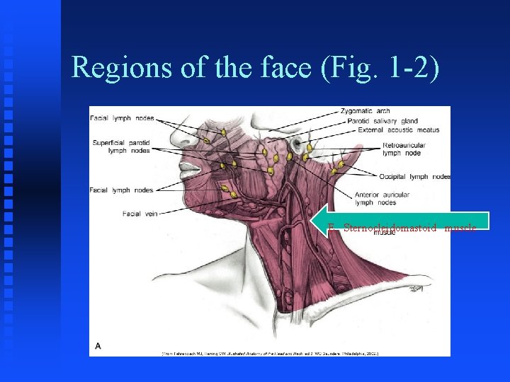 Regions of the face (Fig. 1 -2) E. Sternocleidomastoid muscle Regions of the face (Fig. 1 -2) E. Sternocleidomastoid muscle