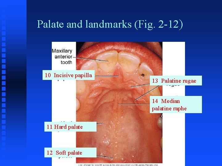 Palate and landmarks (Fig. 2 -12) 10 Incisive papilla 13 Palatine rugae 14 Median