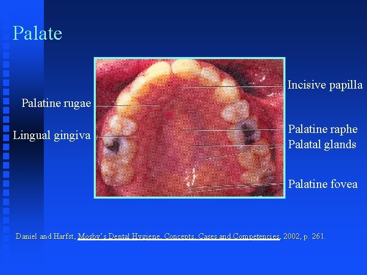 Palate Incisive papilla Palatine rugae Lingual gingiva Palatine raphe Palatal glands Palatine fovea Daniel Palate Incisive papilla Palatine rugae Lingual gingiva Palatine raphe Palatal glands Palatine fovea Daniel