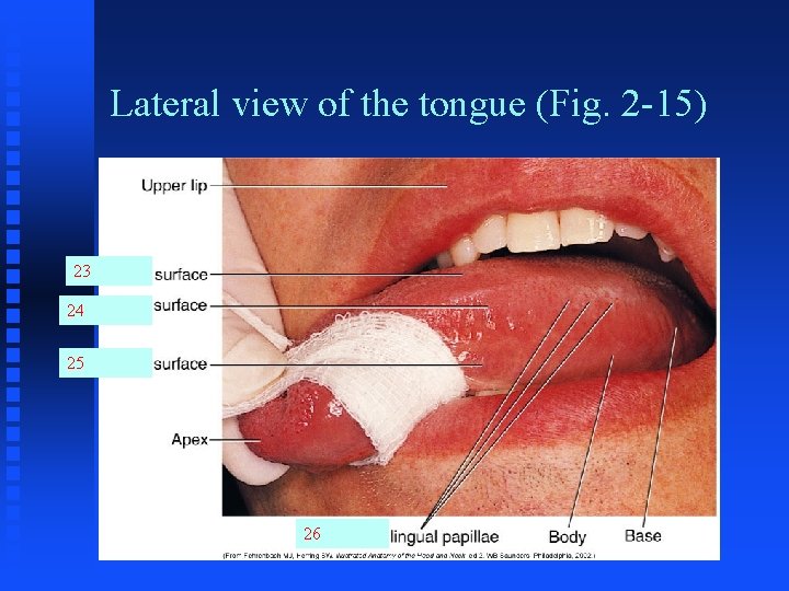 Lateral view of the tongue (Fig. 2 -15) 23 24 25 26 