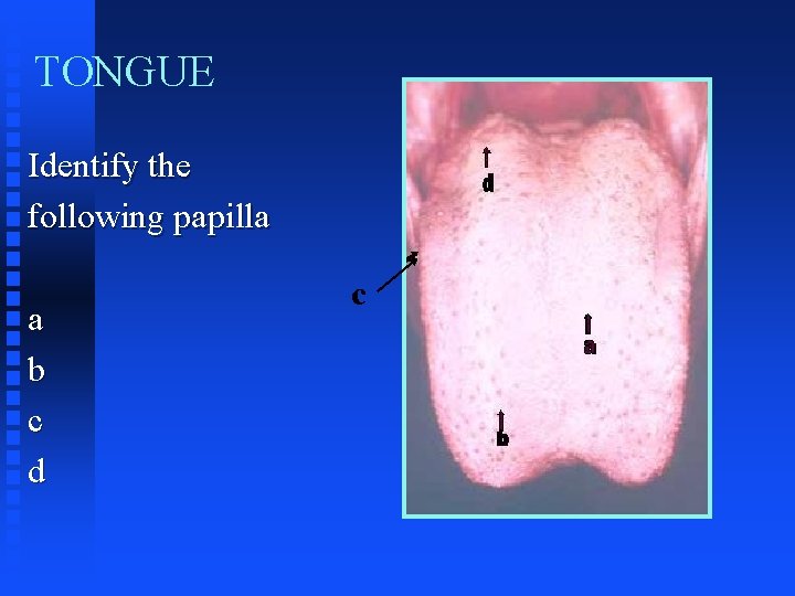 TONGUE Identify the following papilla a b c d c 