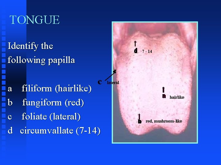 TONGUE Identify the following papilla a b c d 7 - 14 c filiform TONGUE Identify the following papilla a b c d 7 - 14 c filiform