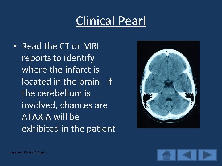 Clinical Pearl • Read the CT or MRI reports to identify where the infarct