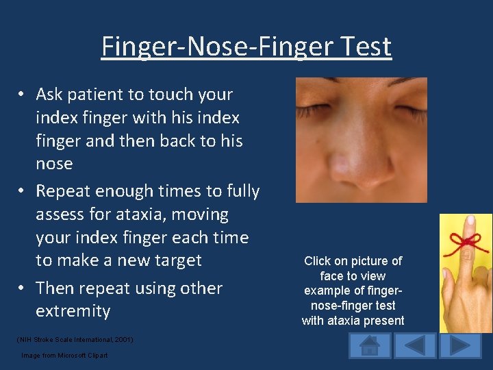 Finger-Nose-Finger Test • Ask patient to touch your index finger with his index finger