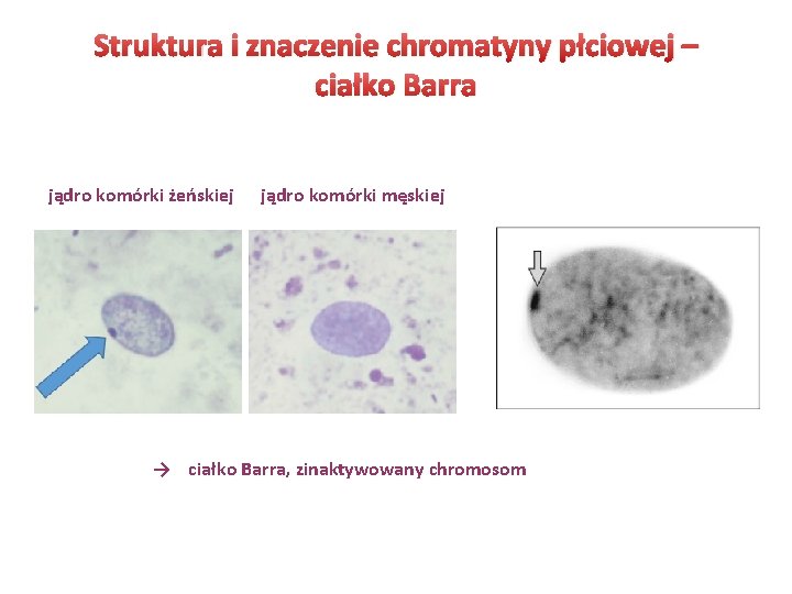 Struktura i znaczenie chromatyny płciowej – ciałko Barra jądro komórki żeńskiej jądro komórki męskiej Struktura i znaczenie chromatyny płciowej – ciałko Barra jądro komórki żeńskiej jądro komórki męskiej