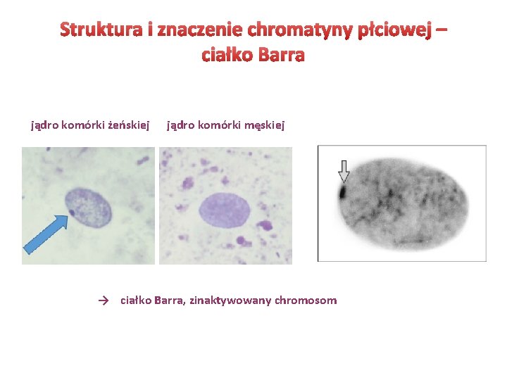 Struktura i znaczenie chromatyny płciowej – ciałko Barra jądro komórki żeńskiej jądro komórki męskiej